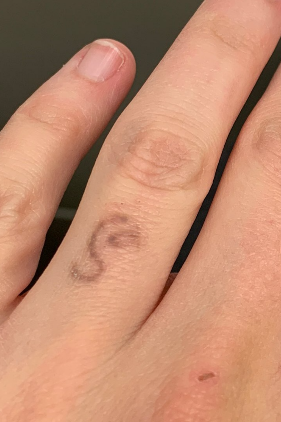 Ring Tattoo Before